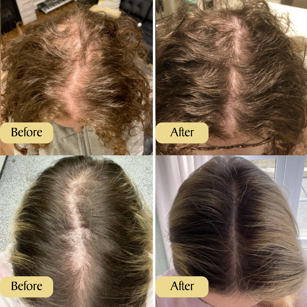 Hairvana Natural Growth Oil (Buy 1 Get 1 Free)