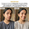 Layali Follicle Calm Oil (Buy 1 Get 1 Free) 1