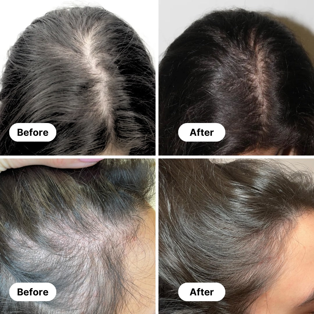 Hairvana Natural Growth Oil (Buy 1 Get 1 Free)