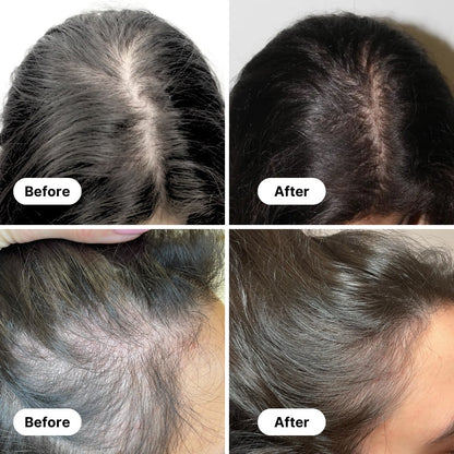 Hairvana Natural Growth Oil (Buy 1 Get 1 Free)