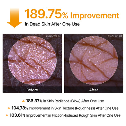 Peel Shot Skin Brightening Spray (Buy 1 Get 1 Free)